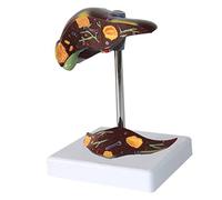 Modello anatomico, Modello anatomico del fegato umano di malattia, modello, for aiuti alla formazione medica