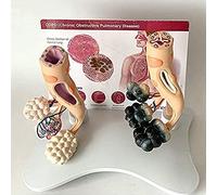 modello anatomico Modello anatomico di patologia polmonare normale, modello confronto tra polmone sano e patologico, for l'istruzione medico-paziente in aula
