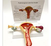 Modello anatomico, Modello anatomico medico di utero umano, modello ovaio uterino con patologie, struttura dell'utero materno simulazione avanzata