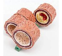 Modello anatomico, Modello di arteria in 4 Pezzi - SangueModello anatomico - Modello anatomico di aterosclerosi dell'art