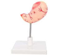 Modello anatomico: modello didattico dello stomaco umano per l'educazione