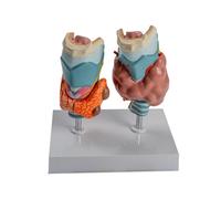 Modello anatomico patologico della tiroide Aiuto didattico in aula per comprendere i disturbi Modello di patologia umana