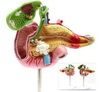 Modello anatomico patologico in scala 1:1 di pancreas, milza, duodeno e cistifellea umana per la formazione medica e il trattamento medico ausiliario