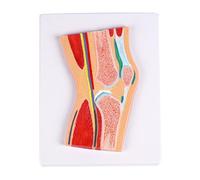 Modello anatomico professionale dell'articolazione del ginocchio della rotula con legamenti muscolari per la comunicazione del paziente e l'allenamento clinico Modello di ginocchio dissectible