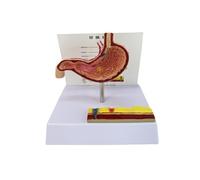 Modello anatomico realistico di perforazione gastrica modello di anatomia dello stomaco patologico per l'insegnamento delle impostazioni cliniche di ricerca