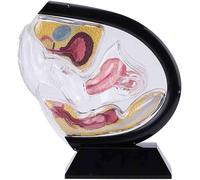 Modello anatomico trasparente dell'utero femminile, modello didattico di utero, bacino e retto, per la formazione e l'istruzione medica(Black)