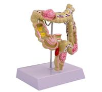 Modello Anatomico Umano Modello Intestinale Umano Grande Modello Intestinale Patologie Umane Del Grande Modello Intestinale Per L'Educazione Scientifica Anatomia Umana Modello Per Studio Scuola Umano
