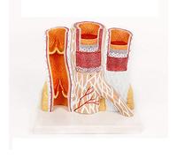 modello anatomico, Un modello ingrandito dei vasi sanguigni umani. Modelli anatomici di arterie e vene for l'istruzione l'apprendimento medico. prolasso vascolare umano