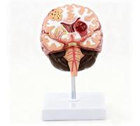 Modello cerebrale cardiovascolare e cerebrovascolare per anziani con base | Modello realistico e staccabile del cervello umano patologico, colori vivaci, sussidio didattico per la formazione