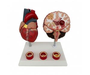 Modello Cerebrale in PVC Modello di Patologia Cardiaca e Cerebrale Scientifico