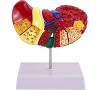Modello colorato di patologia epatica completa, con caratteristiche di base e struttura chiara, modello di anatomia della cirrosi epatica for lo studio e la ricerca scolastica.