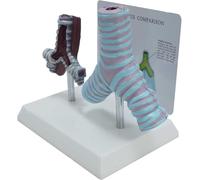 Modello comparativo di bronchi umani fumatori e bronchi sani, modello di anatomia patologica dei bronchi, utilizzato for la ricerca medica e la visualizzazione educativa