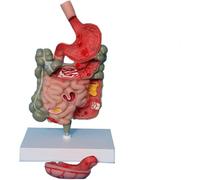Modello con sezione dell'apparato digerente con stomaco rimovibile | Modello di anatomia patologica dello stomaco e dell'intestino umano, strumento dimostrativo di lesioni gastriche
