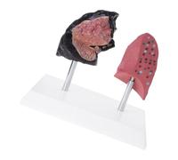 Modello confronto dettagliato tra fumatore e polmone sano Sostanza in PVC per la formazione clinica Educazione fitness Strumento dimostrativo del polmone in PVC