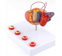 Modello Cuore 1:1 Staccabile con Trombosi per l'Apprendimento | Modello di Cuore Umano Anatomicamente Accurato e Realistico con 34 Segnali Digitali per lo Strumento Didattico in Classe