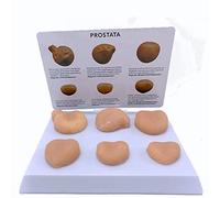 Modello del corpo umano, modello della prostata, modello anatomico del blocco della prostata, utilizzato per la comunicazione medico-paziente e l'educazione medica