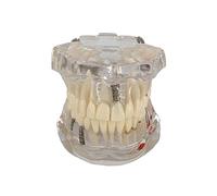 Modello del dente per dentisti, strumento di insegnamento orale mobile | Modello interattivo dei denti per l'educazione dentale - Strumento didattico efficace per la formazione della salute orale e