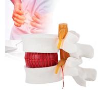 Modello del disco intervertebrale - Dimostrazione della colonna lombare con ingrandimento 1,5x per l'istruzione - Dettagli strutturali realistici