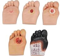 Modello del piede diabetico per dimostrazioni di anatomia e cura delle ferite, lesioni purulente delle ferite, grado 1-5, strumento simulatore per fisiologia e istruzione