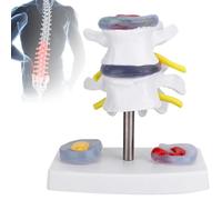 Modello della colonna vertebrale lombare: vertebre a 2 segmenti con base rimovibile, mostra patologia per insegnare, studiare e esporre