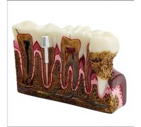 Modello dentale anatomico con sezione trasversale - Rappresentazione dettagliata di denti, gengive e radici dentali per la formazione dentale e la ricerca