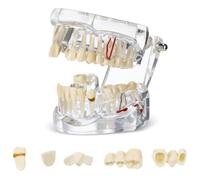 Modello Dentale Con Denti Rimovibili Dimostrazione Standard