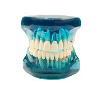 Modello dentale con parentesi graffe,Modello dente trasparente, Modello dentale impianto, Modello dentale ortodontico, demo dell'impianto con corona rimovibile/ponte per la formazione(blu)