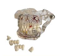 Modello dentale impianto dentale resina con dentista del dente del ponte restaurato per lo studio della malattia medica