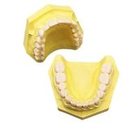 Modello dentale, modello di bocca per formazione odontoiatrica Modello di mascella superiore e inferiore in resina Modello dentale per l'insegnamento dell'odontoiatria(Yellow)