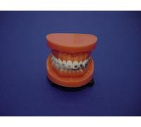 Modello dentale ortodontico brackets metallo e ceramica orthodontic half model