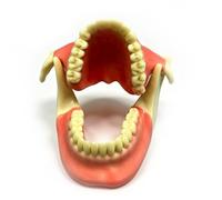 Modello dentale per la pratica di rialzo del seno mascellare mediante impianti, modello dentale per la decomposizione mandibolare, modello anatomico dimostrativo