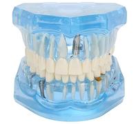 Modello Dentale per Studio e Ricerca - Modello Bocca Acrilica | Modello di studio - Bocca acrilica realistica per l'educazione dentale e la pratica di ricerca