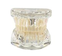 Modello dentale trasparente, modello dentale con parentesi graffe, modello dentale dell'impianto, modello ortodontico, demo dell'impianto con corona/ponte rimovibile per la formazione(bianco)