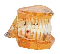 Modello Denti Dimostrativo Staccabile 3 Dimensionale per Educazione All'Implantologia dei Denti