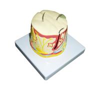 Modello Di Acne Pelle Umana Insegnamento Dimostrazione Anatomia Della Pelle Stereoscopica