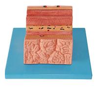 Modello di Allargamento della Parete dello Stomaco Modello del Digestivo - Modelli di Organi Umani Modello Gastrico - per Visualizzazione Didattica Medica Modello Medico