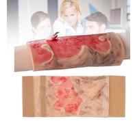 Modello di Allenamento per Ustioni Agli Arti, Ripetizione Del Modulo di Allenamento per Ustioni Agli Arti di 2-3 Gradi, Pad Dimostrativo di Ustioni Indossabili per La Cura Delle Ustioni