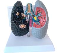 Modello di anatomia broncopolmonare per insegnamento medico - Confronto sano vs fumo con scheda posteriore inglese per visualizzazione educazione sanitaria