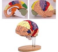 Modello di anatomia del cervello per insegnare e studiare le malattie del | Modello di anatomia del cervello per educare alla neurologia, ideale per studenti e professionisti che studiano disturbi