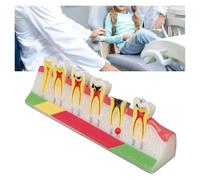 Modello Di Anatomia Del Dente Della, Dimostrazione Anatomica Dei Denti Con Etichette Codificate A Colori, Modello Dentali For Lo Studio Dell'anatomia, L'educazione Medico-paziente E L'igiene Orale