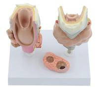 Modello di anatomia della patologia della tiroide umana, set di modelli della tiroide, modello di malattia della tiroide umana con scheda di istruzioni, for l'insegnamento medico