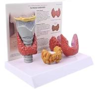 Modello Di Anatomia Della Tiroide, 3:1 Che Mostra Il Modello Di Malattia Della Tiroide Umana, Studio Di Visualizzazione Del Sistema Digestivo Del Nodulo Tiroideo Strumento Didattico Anatomico