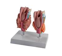 Modello di anatomia della tiroide patologica umana con parti rimovibili Modello anatomico dell'organo uditivo per il rapporto di lezione Struttura tiroidea staccabile