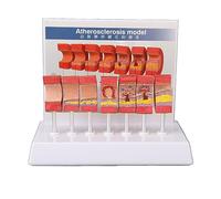 Modello di anatomia dell'arteria 7pcs vaso anatomico aterosclerosi trombo vascolare strumento educativo per uffici medici