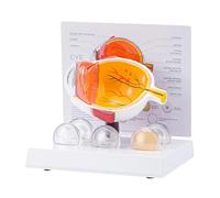 Modello di anatomia dell'occhio umano Realistico Patologico per la Ricerca Uso Educativo e Dimostrazione Clinica Occhio umano