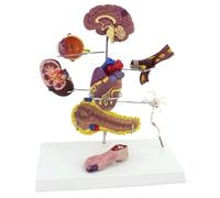 Modello di Anatomia Dell'organo Diabetico Umano, Modello di Organo da 8 Pezzi, Modello di Complicazioni Come Supporto Didattico Educativo