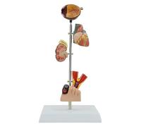Modello di anatomia medica for il diabete, modello dimostrativo di patologia umana, materiale didattico, modello cerebrale, for studi medici e aule