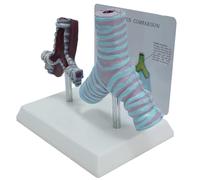 Modello di Anatomia Patologica dei Bronchi Umani, Bronco Fumante E Bronco Sano Modello di Confronto, con Back Card Inglese, per Scuole di Medicina, Ospedali