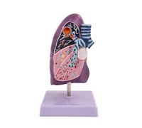 Modello di anatomia polmonare Modello di polmone patologico umano Con base e struttura trasparente Modello di anatomia respiratoria polmonare for modelli didattici di comunicazione