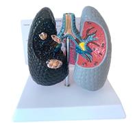 Modello di anatomia polmonare patologica Modello di confronto polmonare e fumare Modello di dimostrazione tracheale Modello di educazione in classe per lezioni mediche
